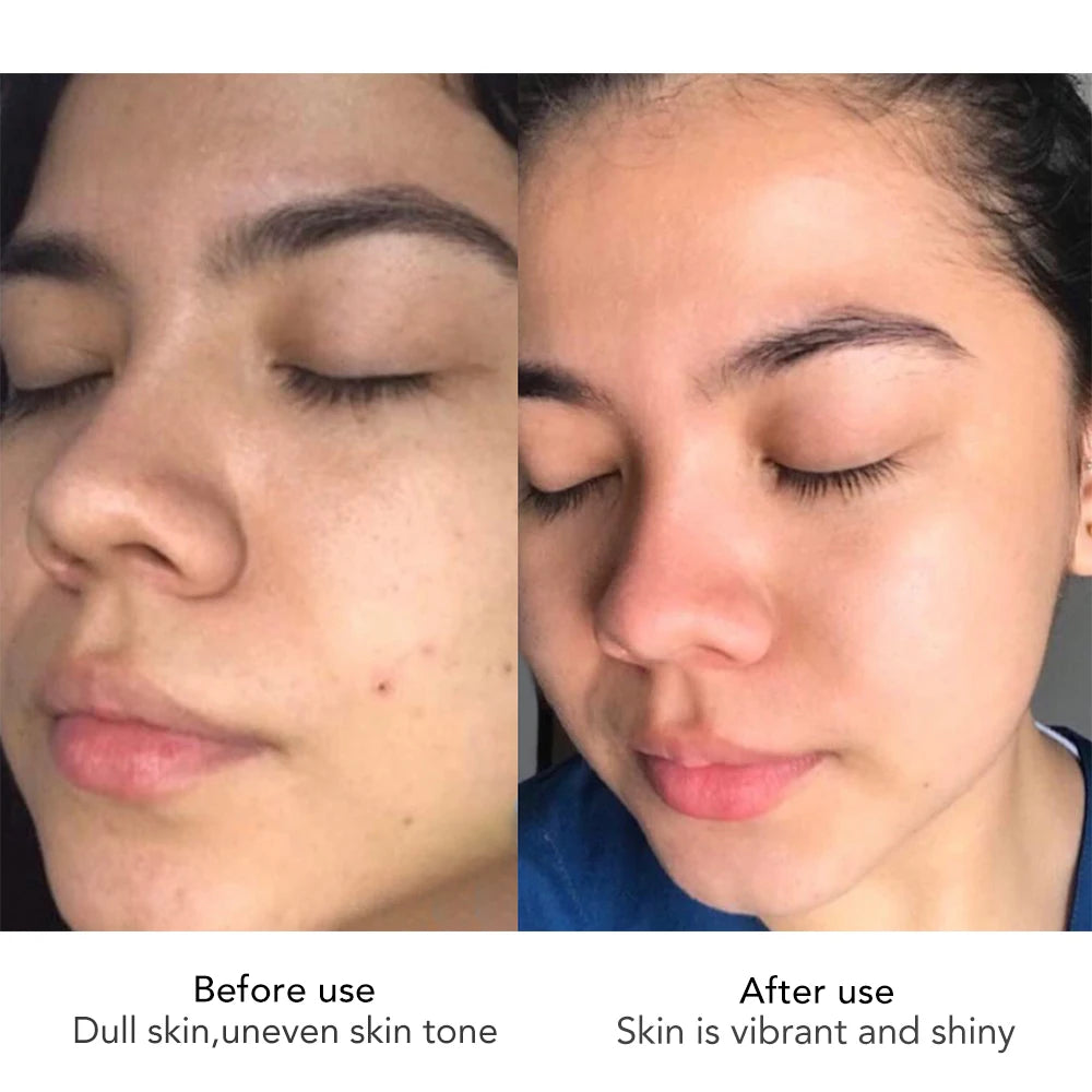 AILKE ANti-aging Whitening Skin Care